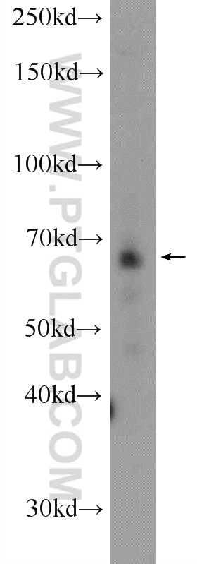 Western Blot (WB) analysis of human placenta tissue using KDELC2 Polyclonal antibody (23345-1-AP)