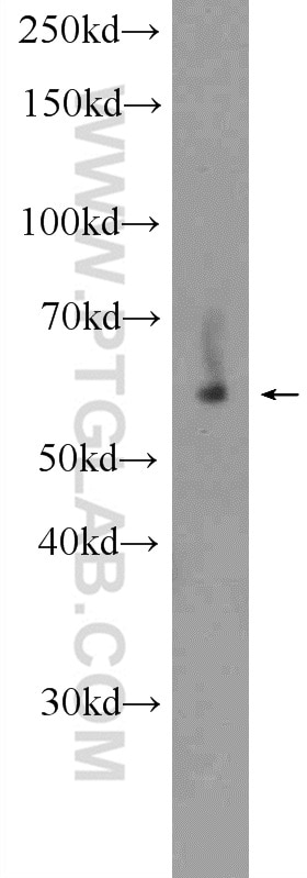 Western Blot (WB) analysis of SMMC-7721 cells using KDELC2 Polyclonal antibody (23345-1-AP)