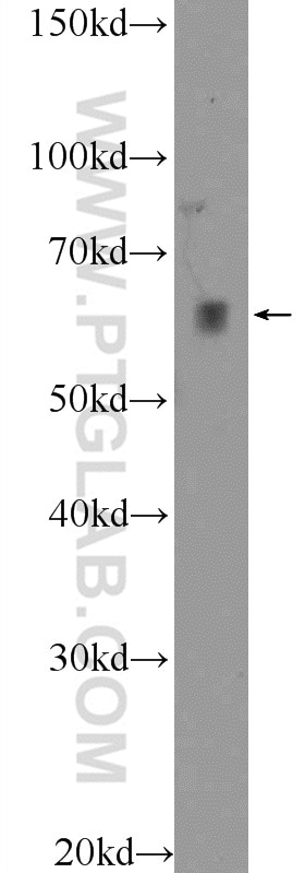 Western Blot (WB) analysis of HeLa cells using KDELC2 Polyclonal antibody (23345-1-AP)