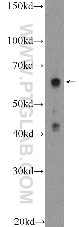 Western Blot (WB) analysis of HeLa cells using KDELC2 Polyclonal antibody (23345-1-AP)