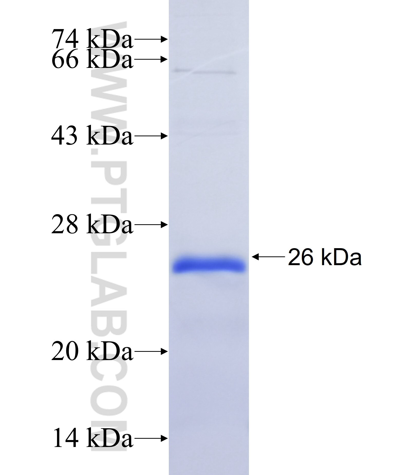 C1orf172 fusion protein Ag37163 SDS-PAGE C1orf172 fusion protein Ag37163 SDS-PAGE