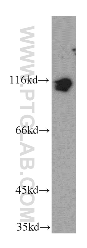 KDM1 Polyclonal antibody