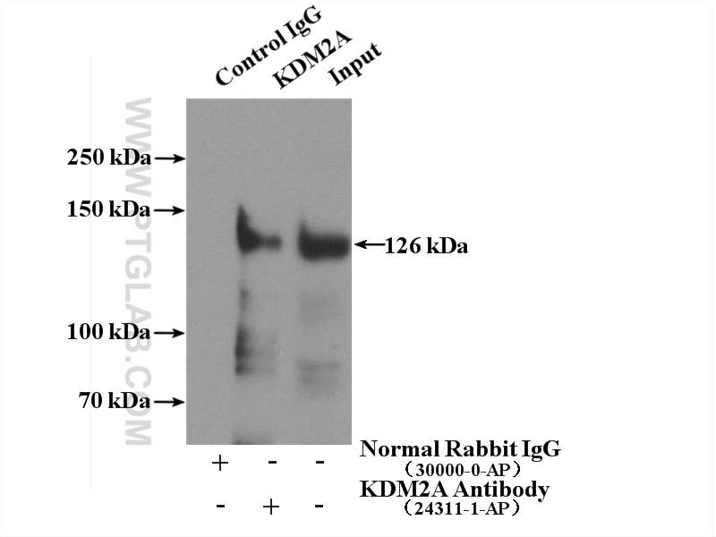 Immunoprecipitation (IP) experiment of HeLa cells using KDM2A Polyclonal antibody (24311-1-AP)