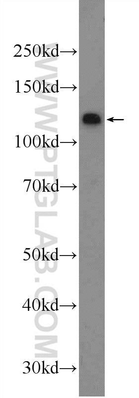 Western Blot (WB) analysis of Jurkat cells using KDM2A Polyclonal antibody (24311-1-AP)