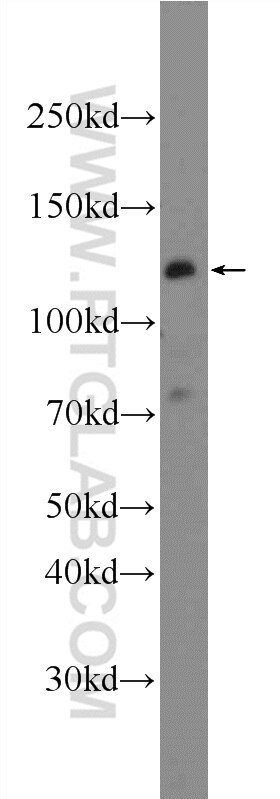 Western Blot (WB) analysis of NIH/3T3 cells using KDM2A Polyclonal antibody (24311-1-AP)
