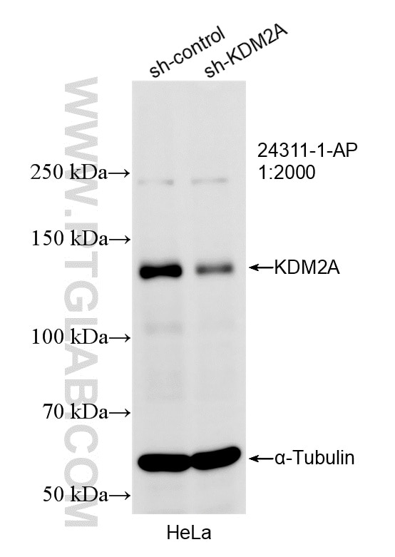 Western Blot (WB) analysis of HeLa cells using KDM2A Polyclonal antibody (24311-1-AP)