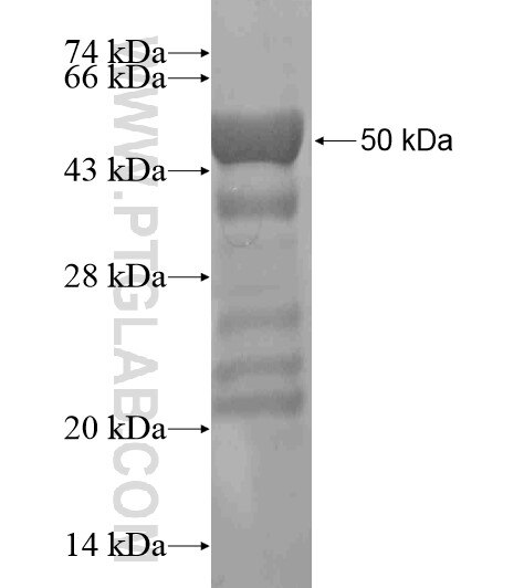 KDM2A fusion protein Ag19448 SDS-PAGE