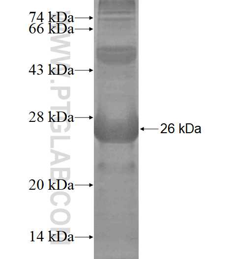 KDM2A fusion protein Ag19467 SDS-PAGE