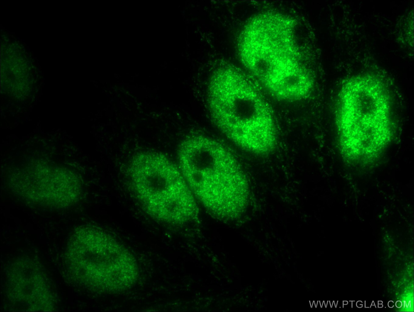 Immunofluorescence (IF) / fluorescent staining of HepG2 cells using KDM3A/JMJD1A Polyclonal antibody (12835-1-AP)