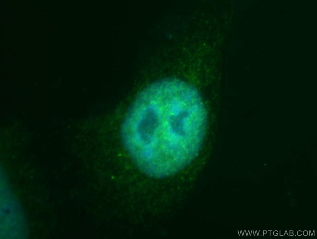 IF Staining of HepG2 using 12835-1-AP