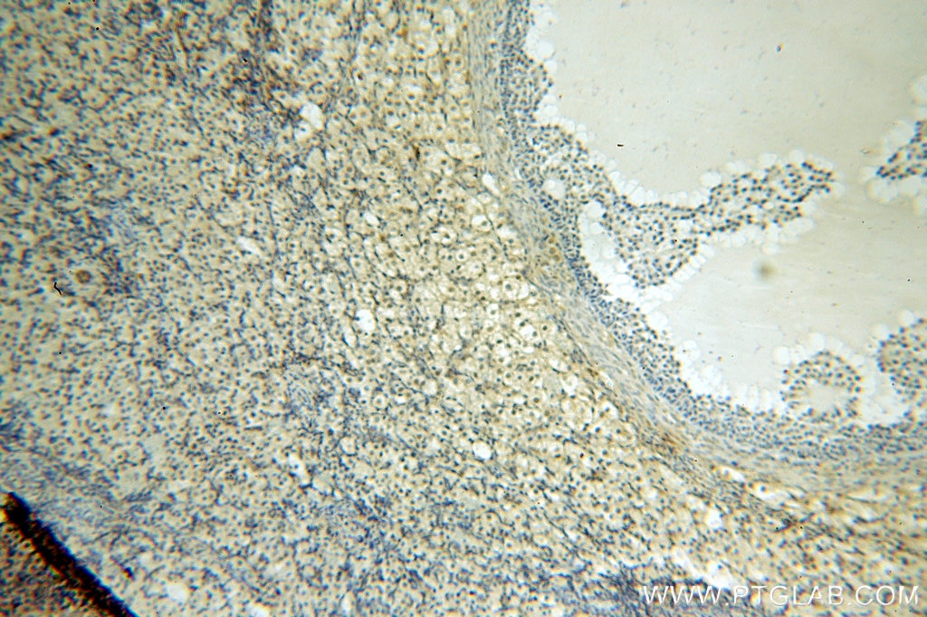 IHC staining of human ovary using 12835-1-AP