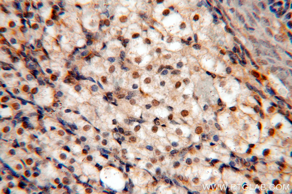 Immunohistochemistry (IHC) staining of human ovary tissue using KDM3A,JMJD1A Polyclonal antibody (12835-1-AP)
