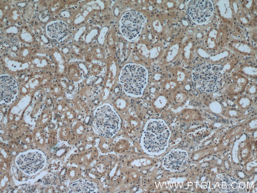 Immunohistochemistry (IHC) staining of human kidney tissue using KDM3A,JMJD1A Polyclonal antibody (12835-1-AP)