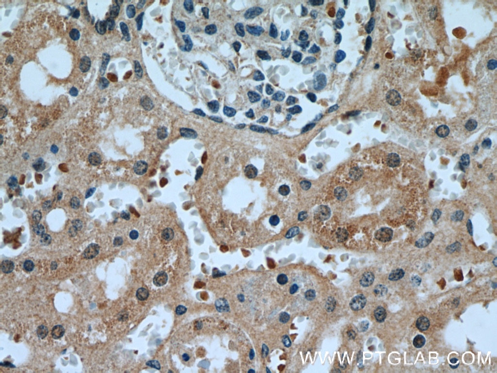 Immunohistochemistry (IHC) staining of human kidney tissue using KDM3A,JMJD1A Polyclonal antibody (12835-1-AP)