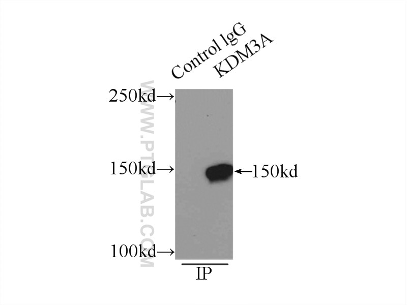 Immunoprecipitation (IP) experiment of HeLa cells using KDM3A,JMJD1A Polyclonal antibody (12835-1-AP)