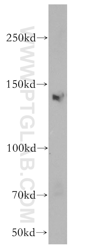 Western Blot (WB) analysis of HeLa cells using KDM3A,JMJD1A Polyclonal antibody (12835-1-AP)