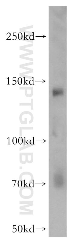 Western Blot (WB) analysis of MCF-7 cells using KDM3A,JMJD1A Polyclonal antibody (12835-1-AP)