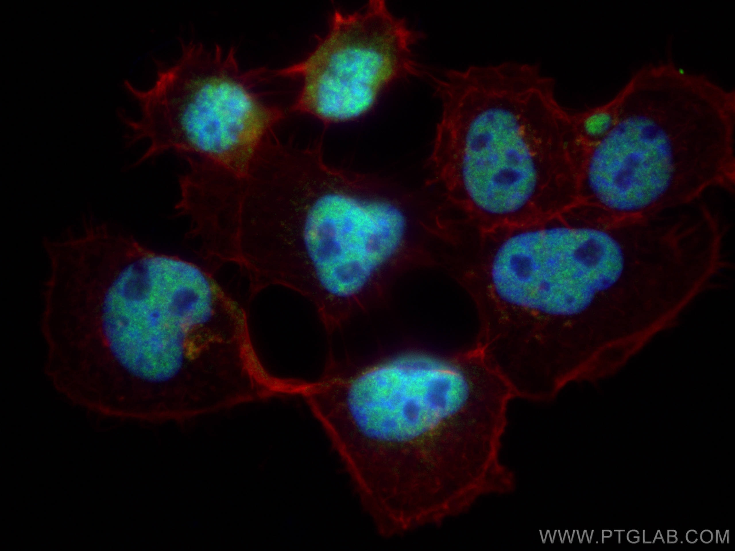 Immunofluorescence (IF) / fluorescent staining of A431 cells using KDM3B Polyclonal antibody (19915-1-AP)