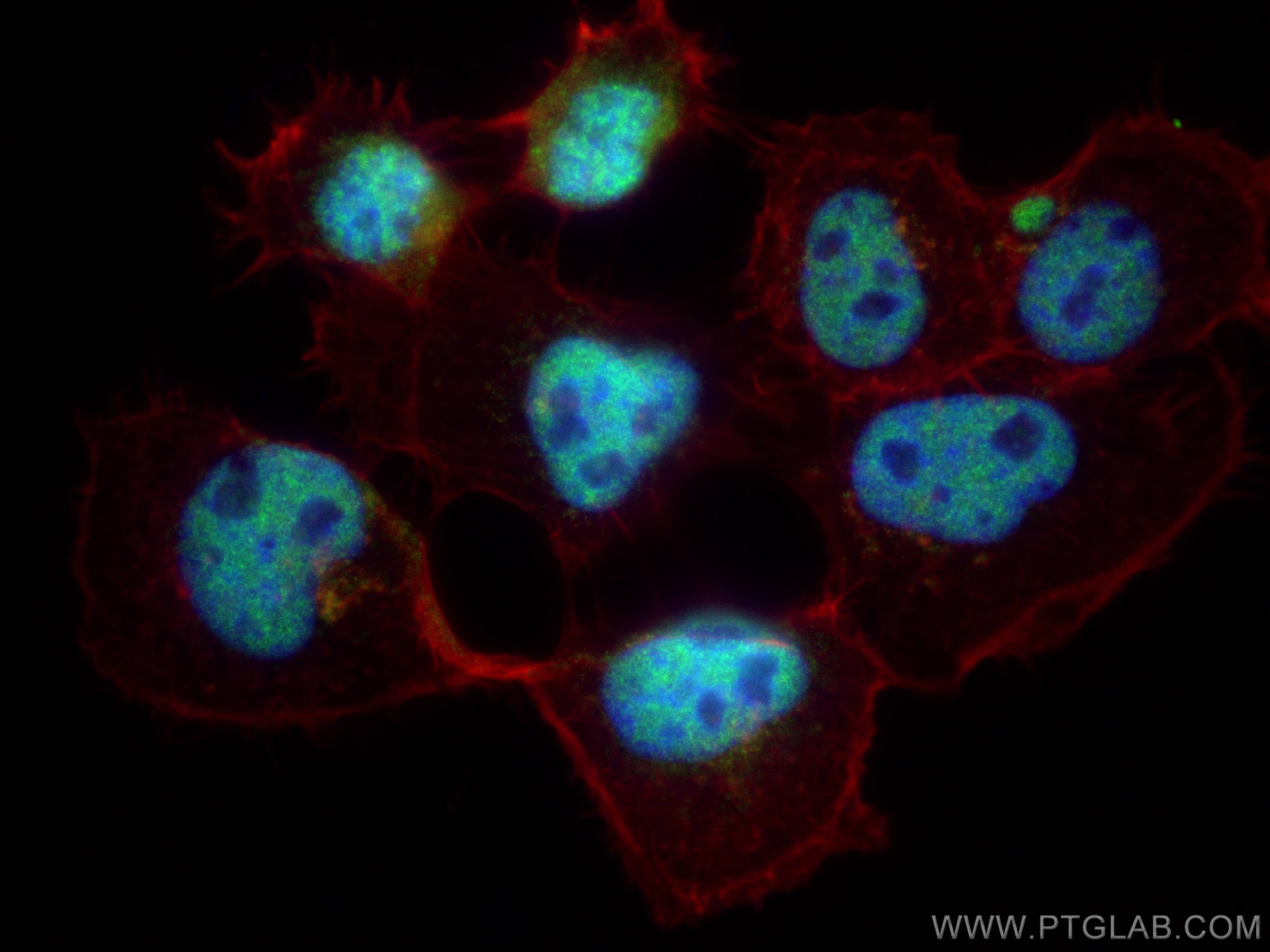 IF Staining of A431 using 19915-1-AP