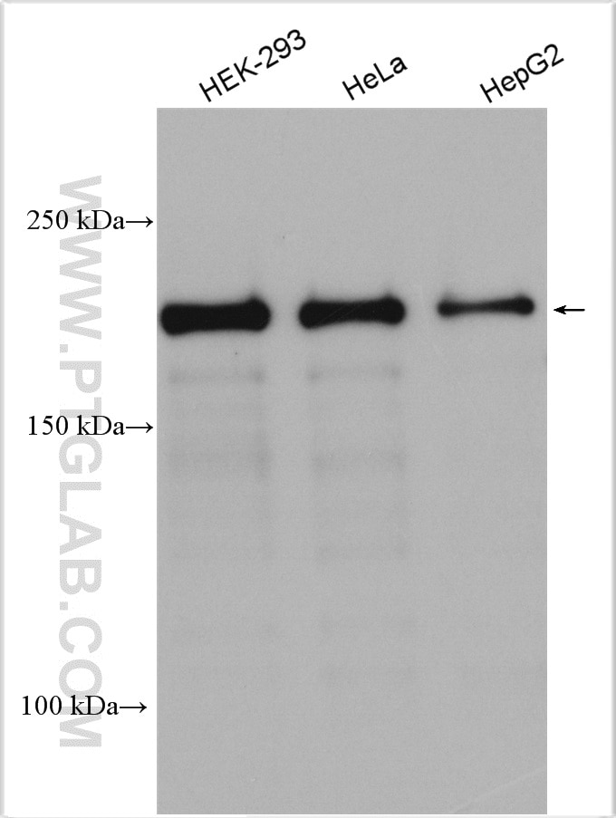 Western Blot (WB) analysis of various lysates using KDM3B Polyclonal antibody (19915-1-AP)