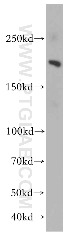 KDM3B Polyclonal antibody