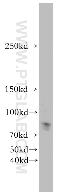 Western Blot (WB) analysis of human placenta tissue using KDM3B Polyclonal antibody (19915-1-AP)