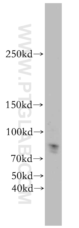 WB analysis of human placenta using 19915-1-AP