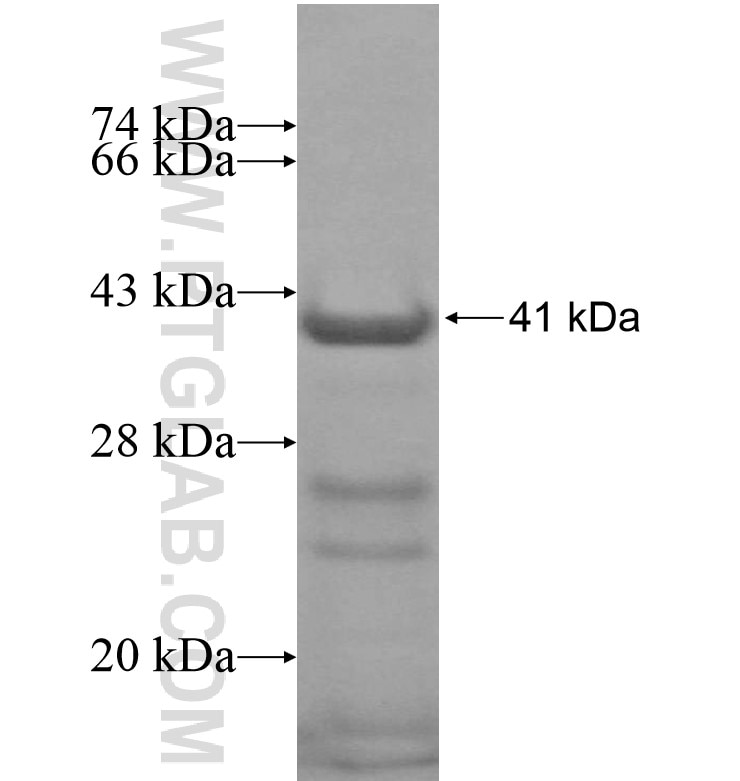 KDM3B fusion protein Ag16809 SDS-PAGE