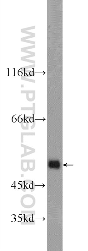 Western Blot (WB) analysis of NIH/3T3 cells using KDM4A Polyclonal antibody (24943-1-AP)