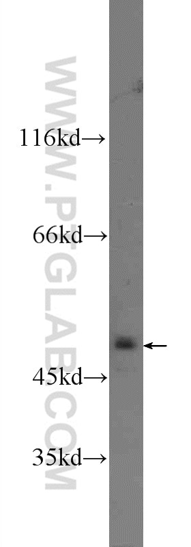 Western Blot (WB) analysis of MCF-7 cells using KDM4A Polyclonal antibody (24943-1-AP)