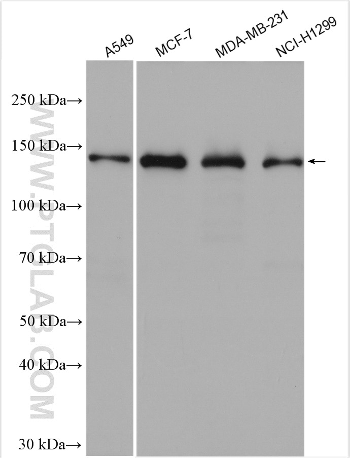 Western Blot (WB) analysis of various lysates using KDM4A Polyclonal antibody (29977-1-AP)