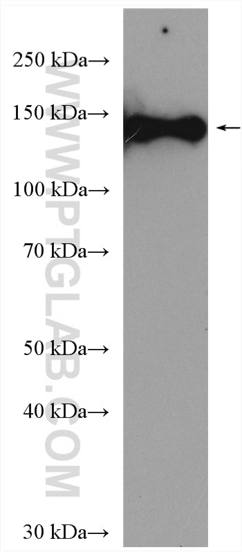 Western Blot (WB) analysis of mouse lung tissue using KDM4A Polyclonal antibody (29977-1-AP)