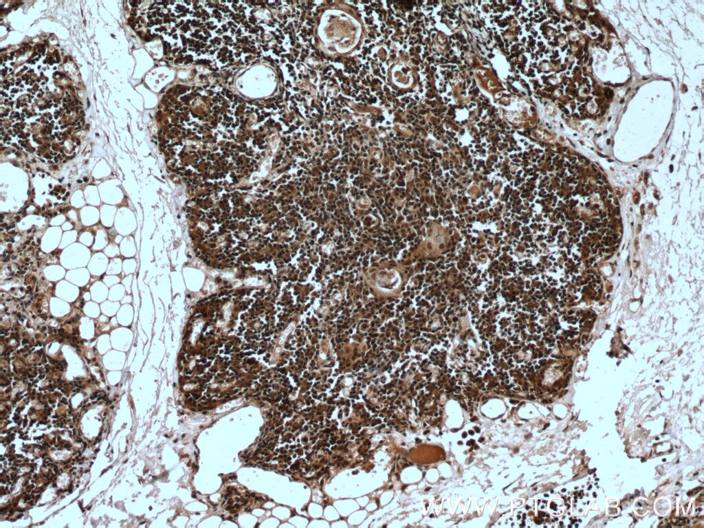 Immunohistochemistry (IHC) staining of human thymus tissue using KDM4D Polyclonal antibody (22591-1-AP)