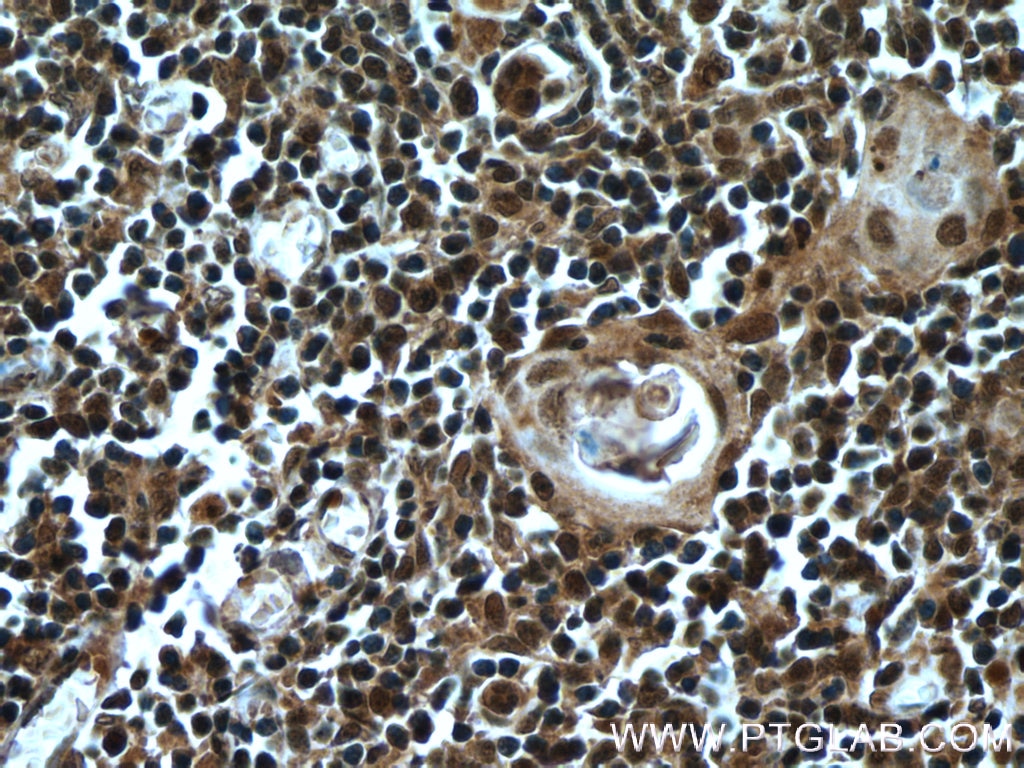 Immunohistochemistry (IHC) staining of human thymus tissue using KDM4D Polyclonal antibody (22591-1-AP)