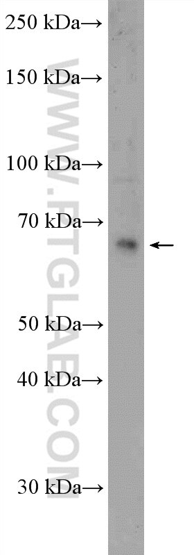 Western Blot (WB) analysis of PC-3 cells using KDM4D Polyclonal antibody (22591-1-AP)