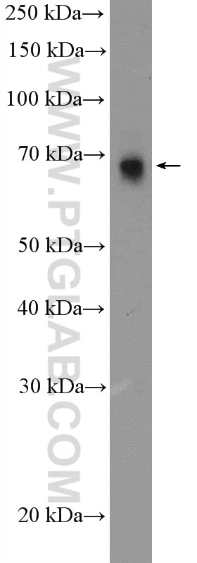 Western Blot (WB) analysis of PC-3 cells using KDM4D Polyclonal antibody (22591-1-AP)