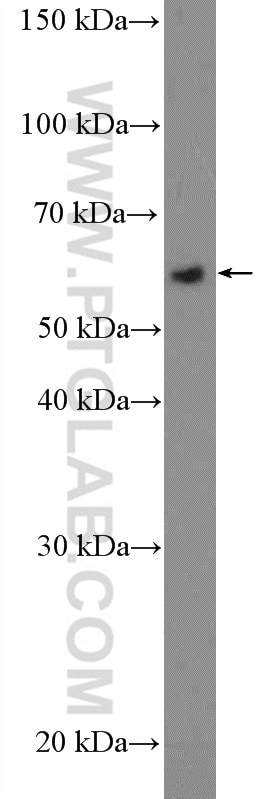Western Blot (WB) analysis of PC-3 cells using KDM4D Polyclonal antibody (22591-1-AP)