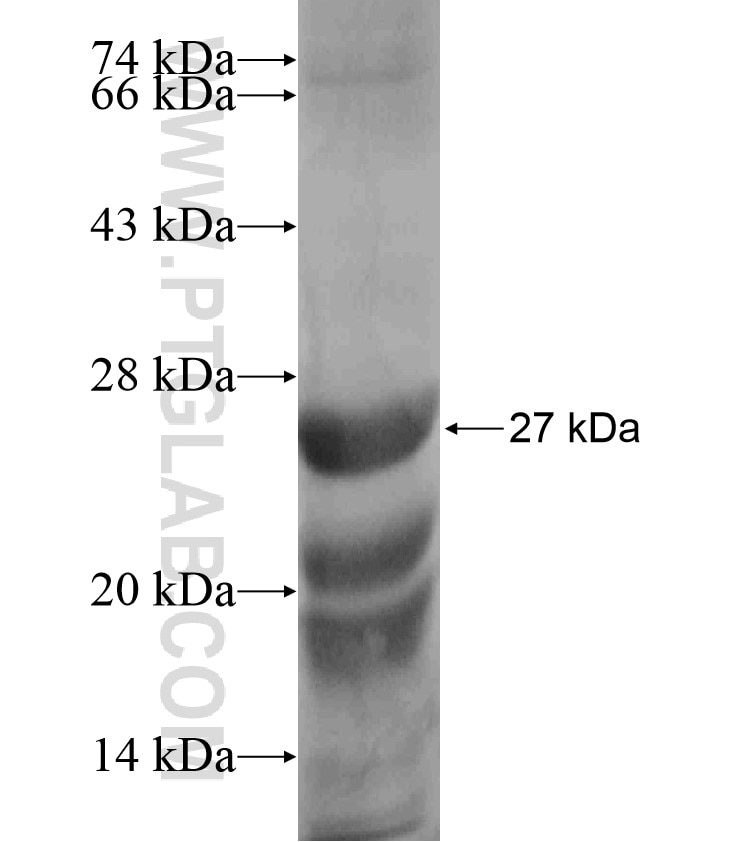 KDM4D fusion protein Ag18416 SDS-PAGE