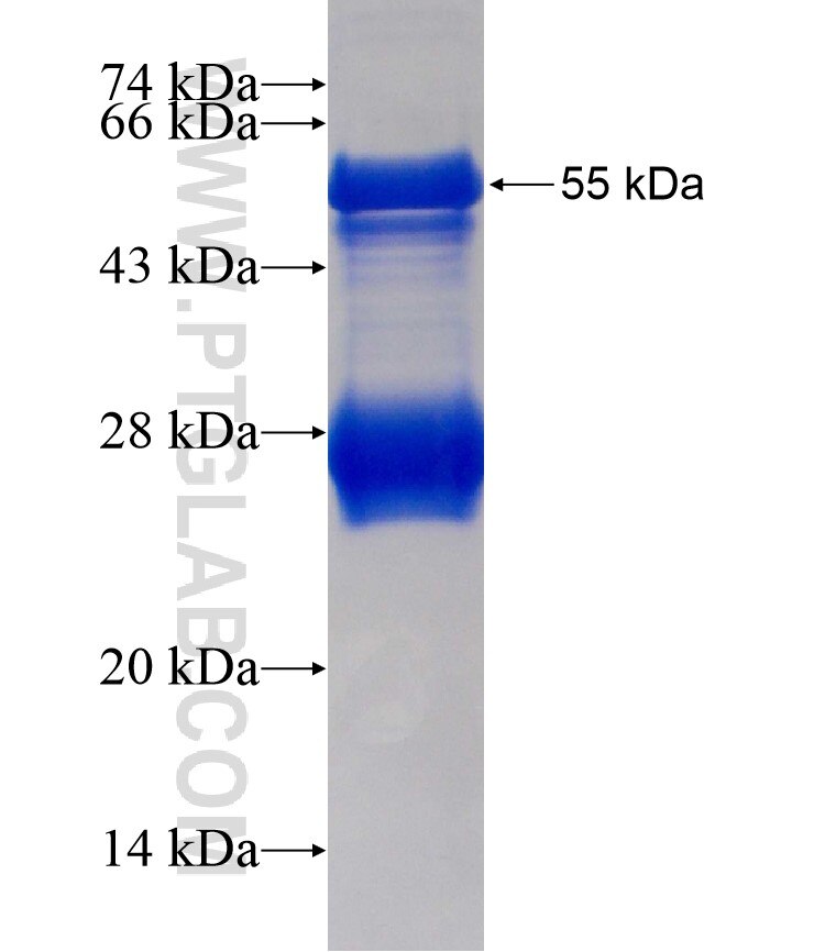 KDM4D fusion protein Ag18436 SDS-PAGE
