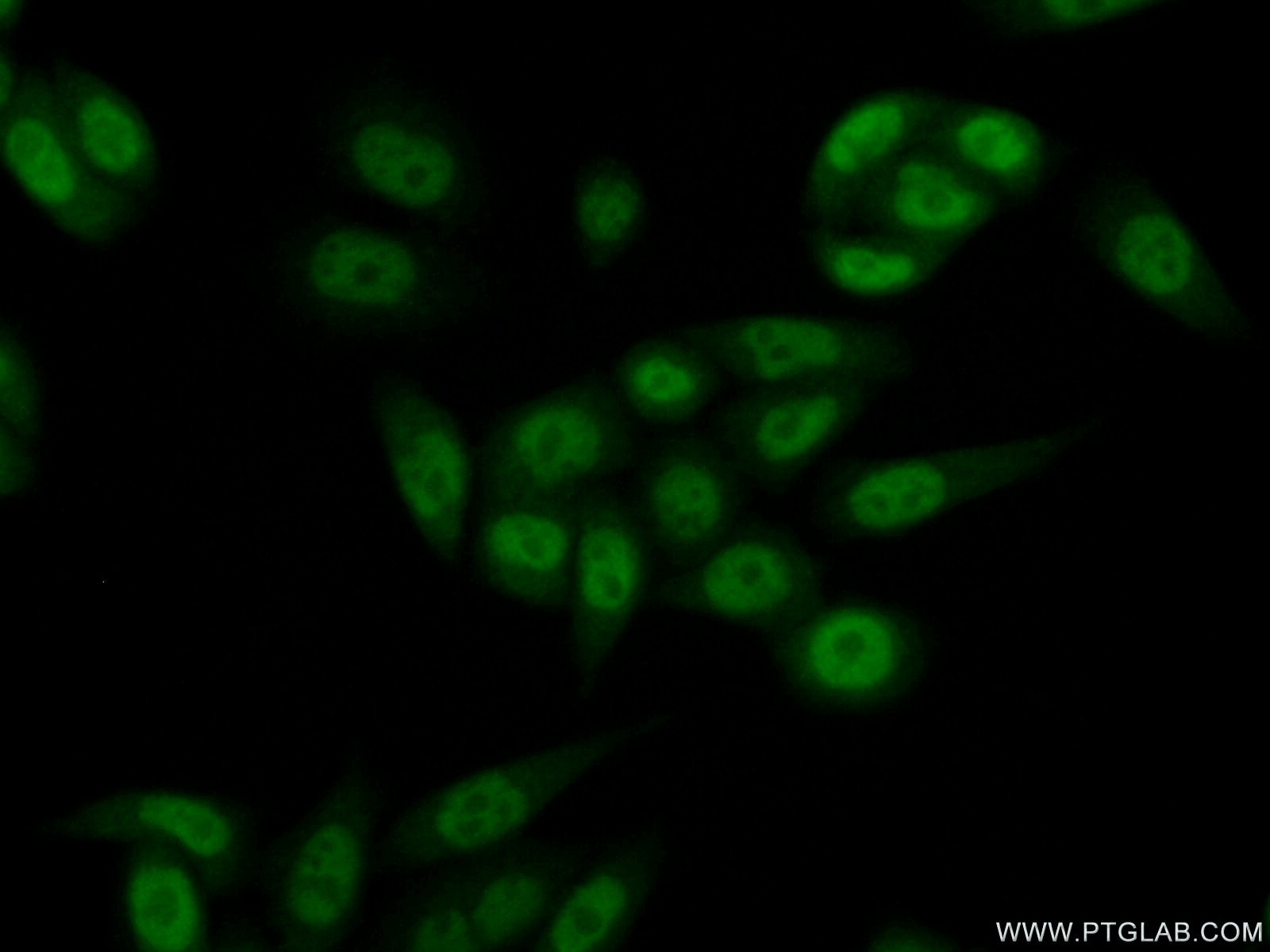 Immunofluorescence (IF) / fluorescent staining of HeLa cells using RBP2 Polyclonal antibody (18825-1-AP)