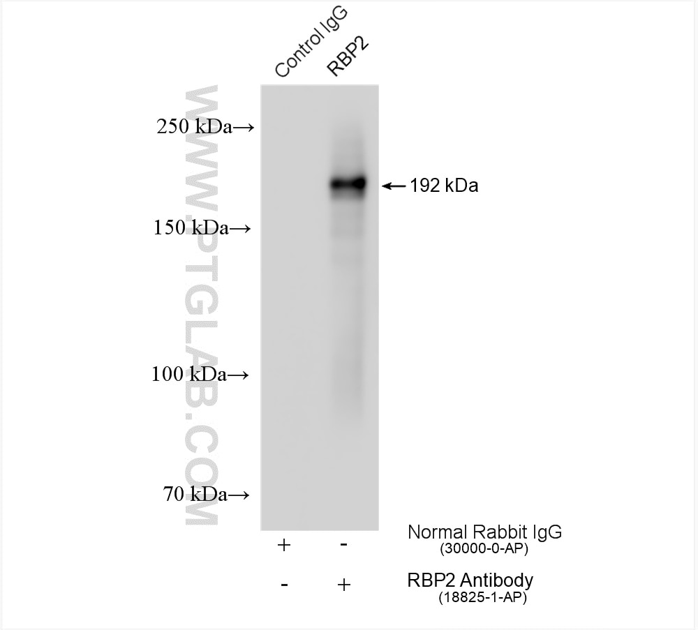 Immunoprecipitation (IP) experiment of HeLa cells using RBP2 Polyclonal antibody (18825-1-AP)