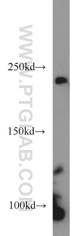 Western Blot (WB) analysis of HeLa cells using RBP2 Polyclonal antibody (18825-1-AP)