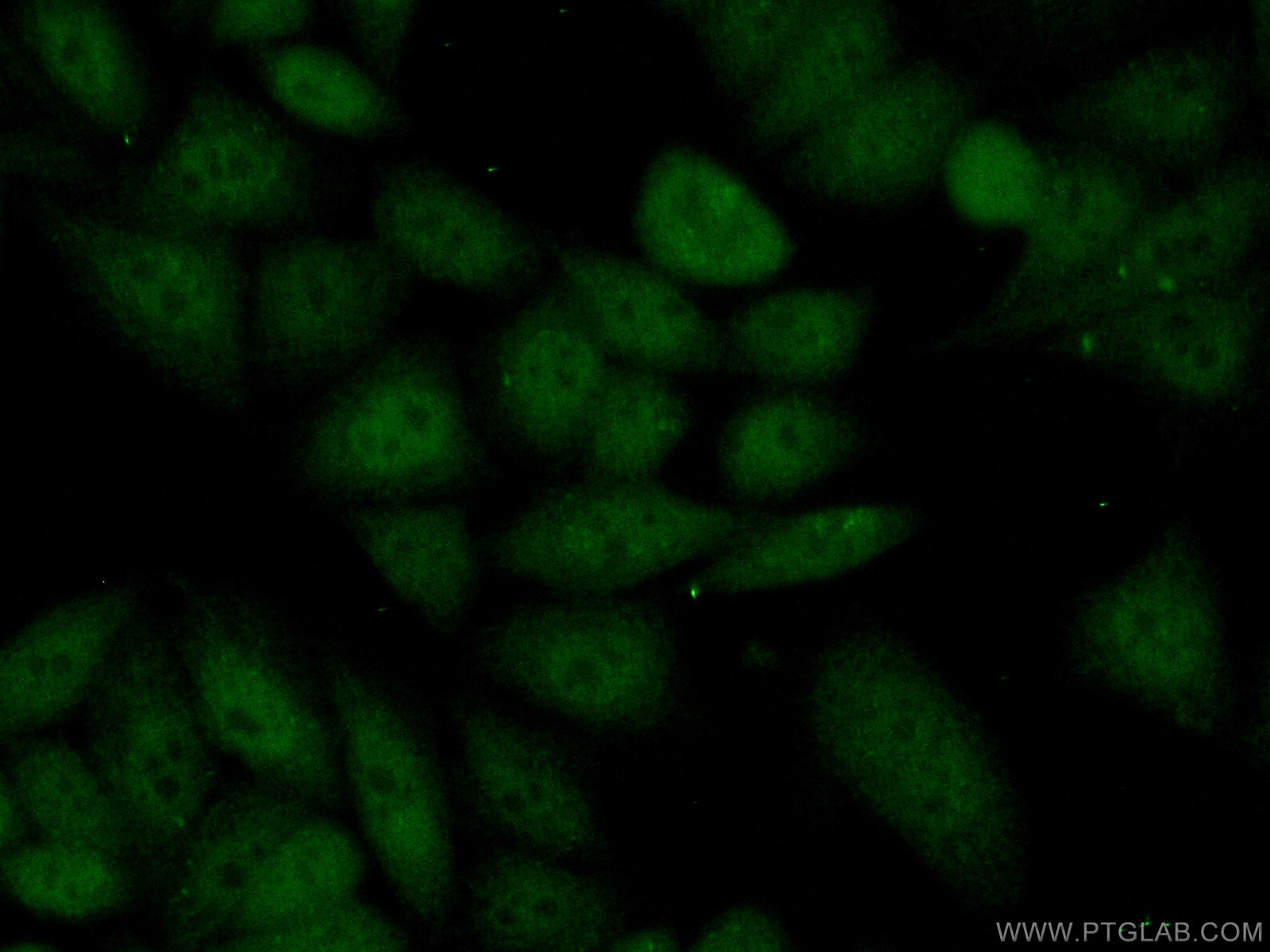 Immunofluorescence (IF) / fluorescent staining of HeLa cells using KDM5C Polyclonal antibody (14426-1-AP)