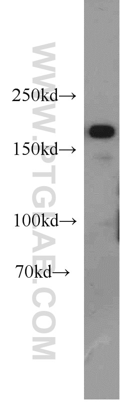 KDM5C Polyclonal antibody