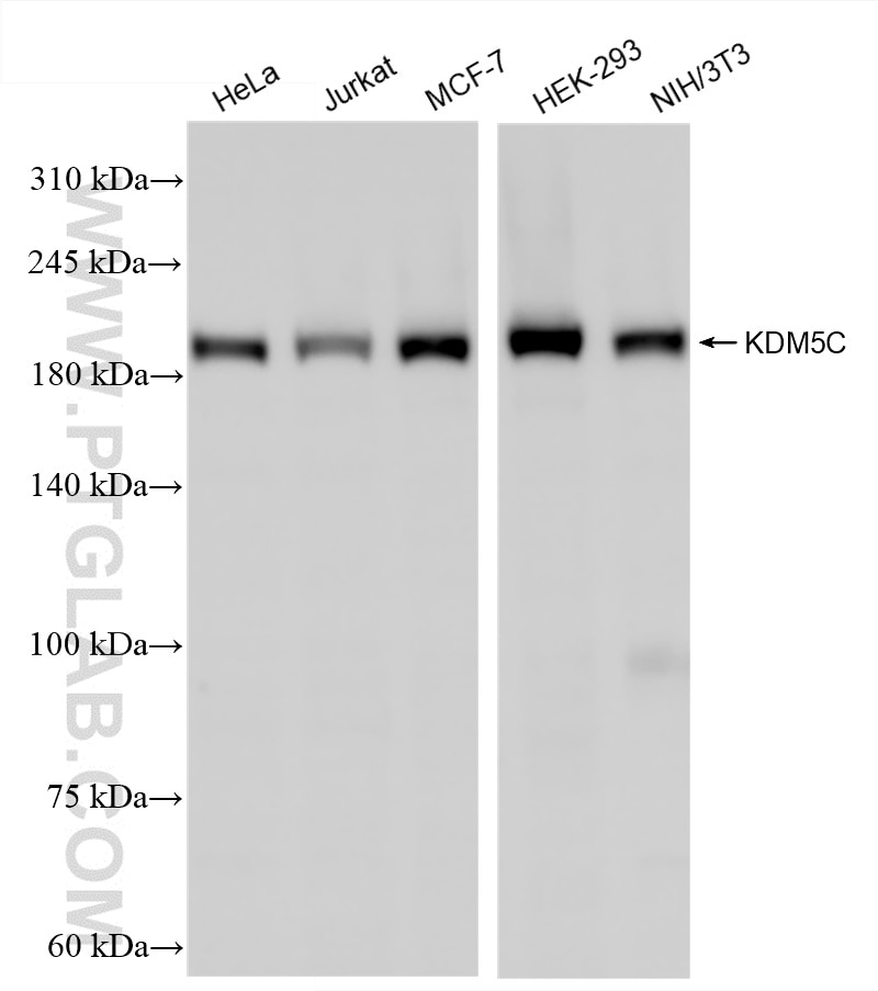 KDM5C