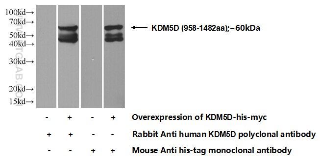 KDM5D