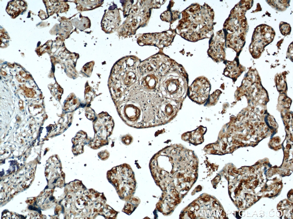 Immunohistochemistry (IHC) staining of human placenta tissue using VEGF Receptor 2 Polyclonal antibody (18975-1-AP)