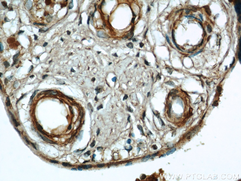 Immunohistochemistry (IHC) staining of human placenta tissue using VEGF Receptor 2 Polyclonal antibody (18975-1-AP)