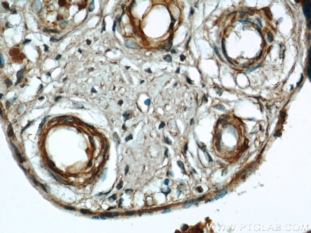 IHC staining of human placenta using 18975-1-AP