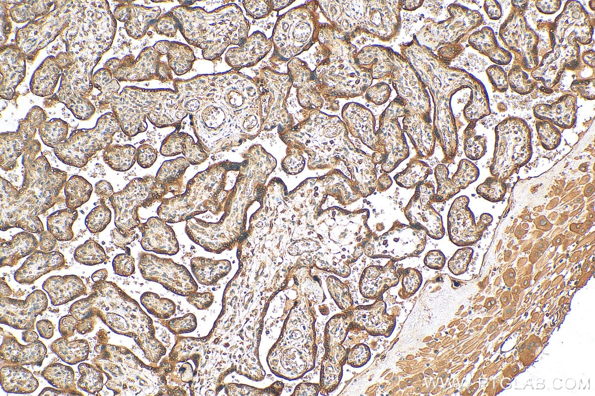Immunohistochemistry (IHC) staining of human placenta tissue using KDSR Polyclonal antibody (16228-1-AP)